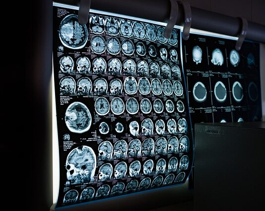 Czy można zrobić rezonans magnetyczny całego kręgosłupa?