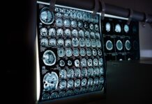 Ile kosztuje tomografia komputerowa kręgosłupa?