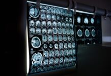 Co widać na tomografii komputerowej? Co widać na tomografii komputerowej?