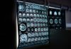 Jak wygląda badanie tomografii komputerowej kręgosłupa?