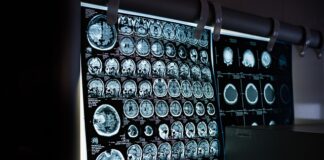 Jak wygląda badanie tomografii komputerowej kręgosłupa?